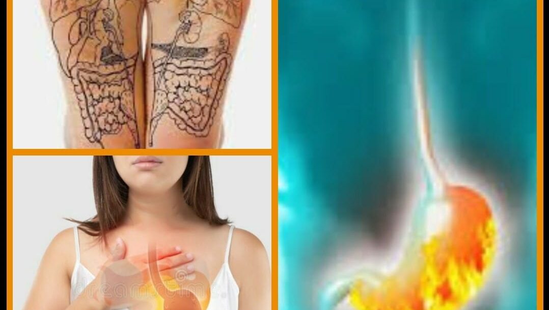 Riflessologia plantare reflusso