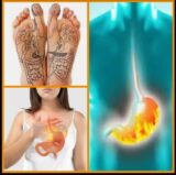 Riflessologia plantare reflusso